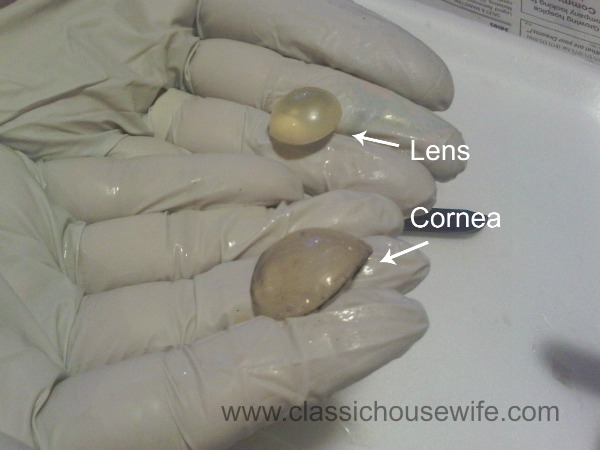 lens-cornea-dissection.jpg